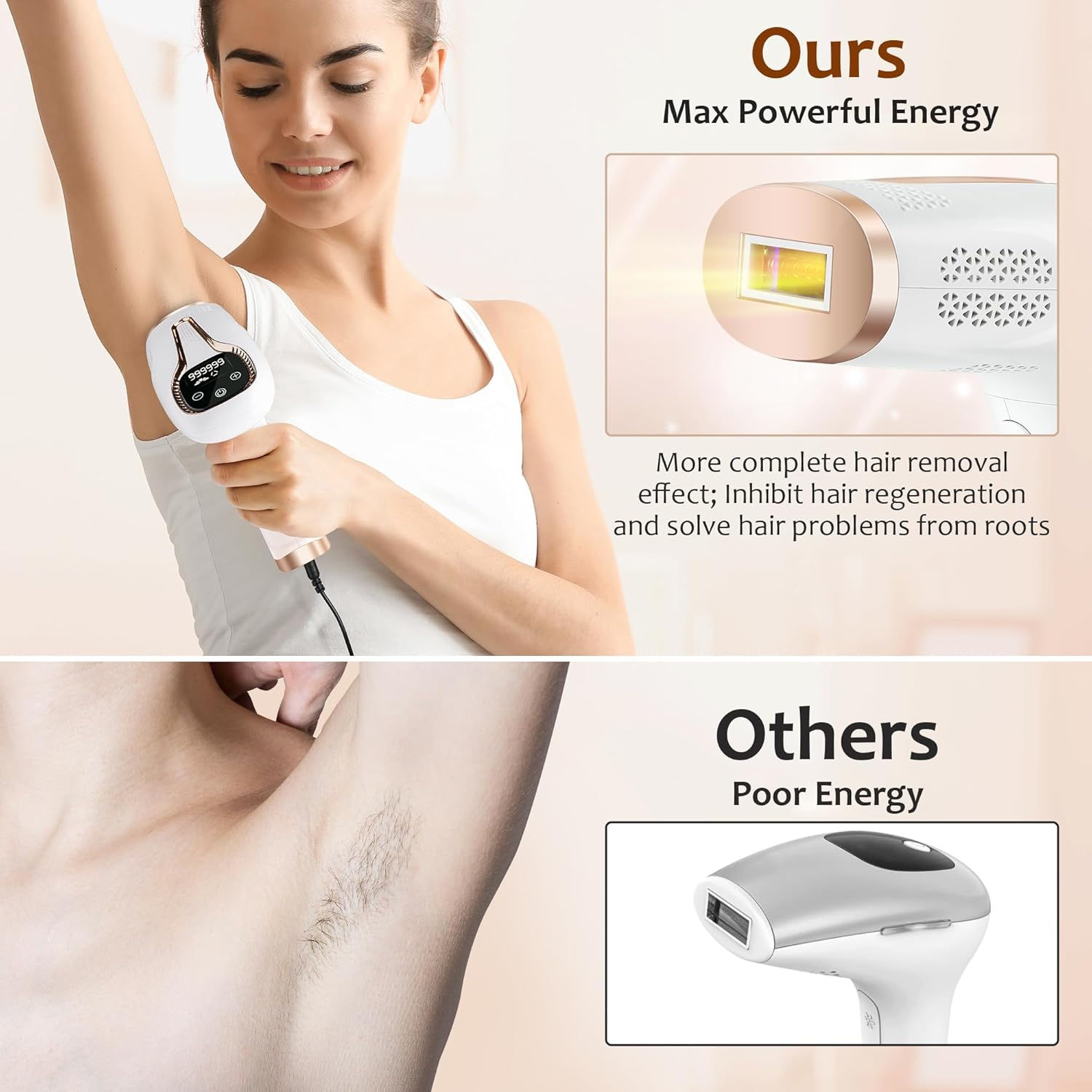 เครื่องกำจัดขนด้วยเลเซอร์ IPL  - Opt Ipl Laser Hair Removal Machine บทวิจารณ์และราคา