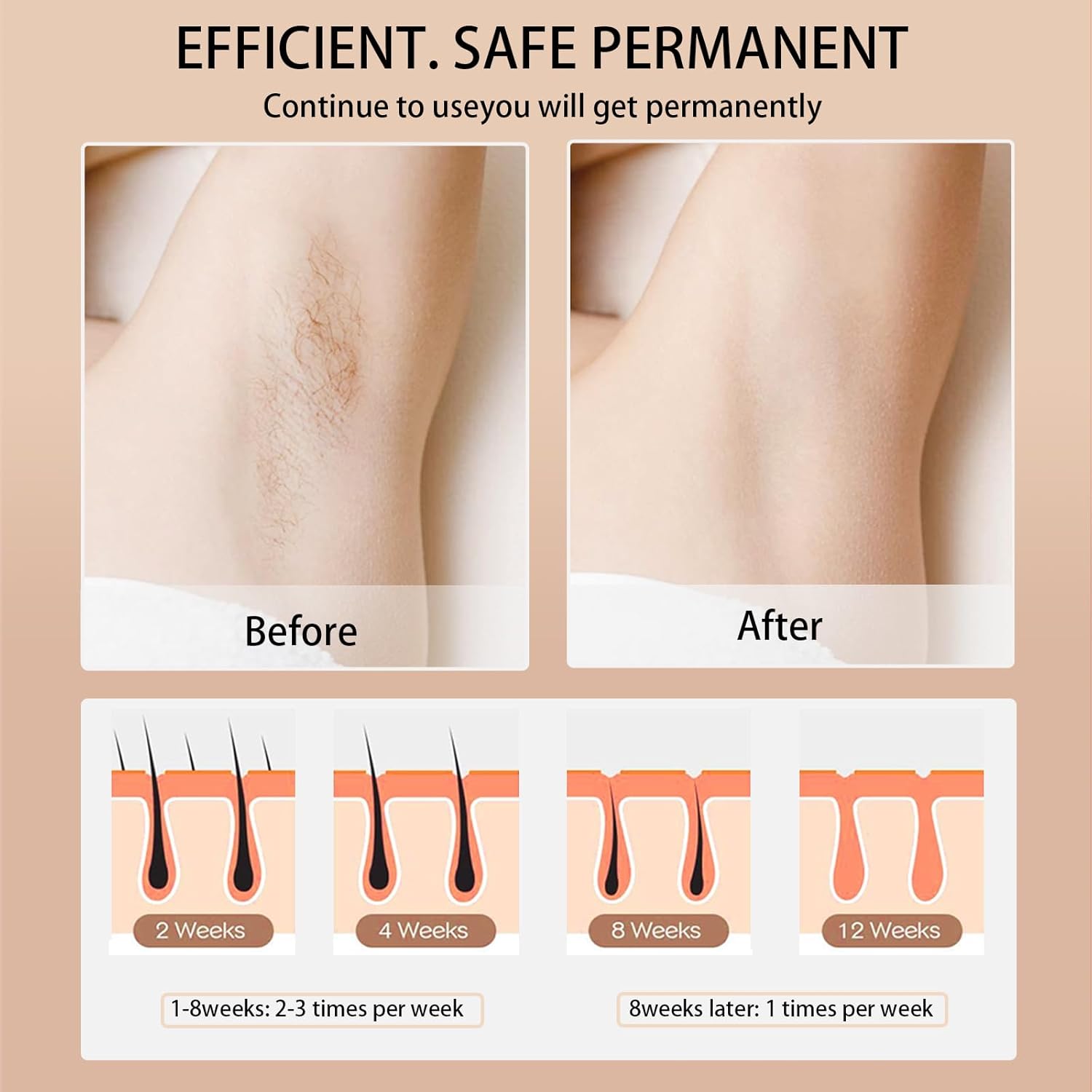 เครื่องกำจัดขนด้วยเลเซอร์ IPL  - Opt Ipl Laser Hair Removal Machine บทวิจารณ์และราคา