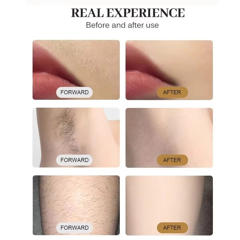 ด้ามจับเครื่องเลเซอร์กำจัดขนได - Cooling Gel For Laser Hair Removal บทวิจารณ์และราคา