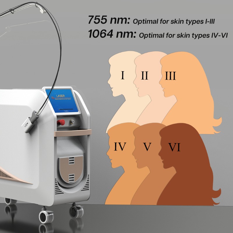 เครื่องกำจัดขนด้วยเลเซอร์ Nd Y - Alexandrite Laser Hair Removal Machine บทวิจารณ์และราคา