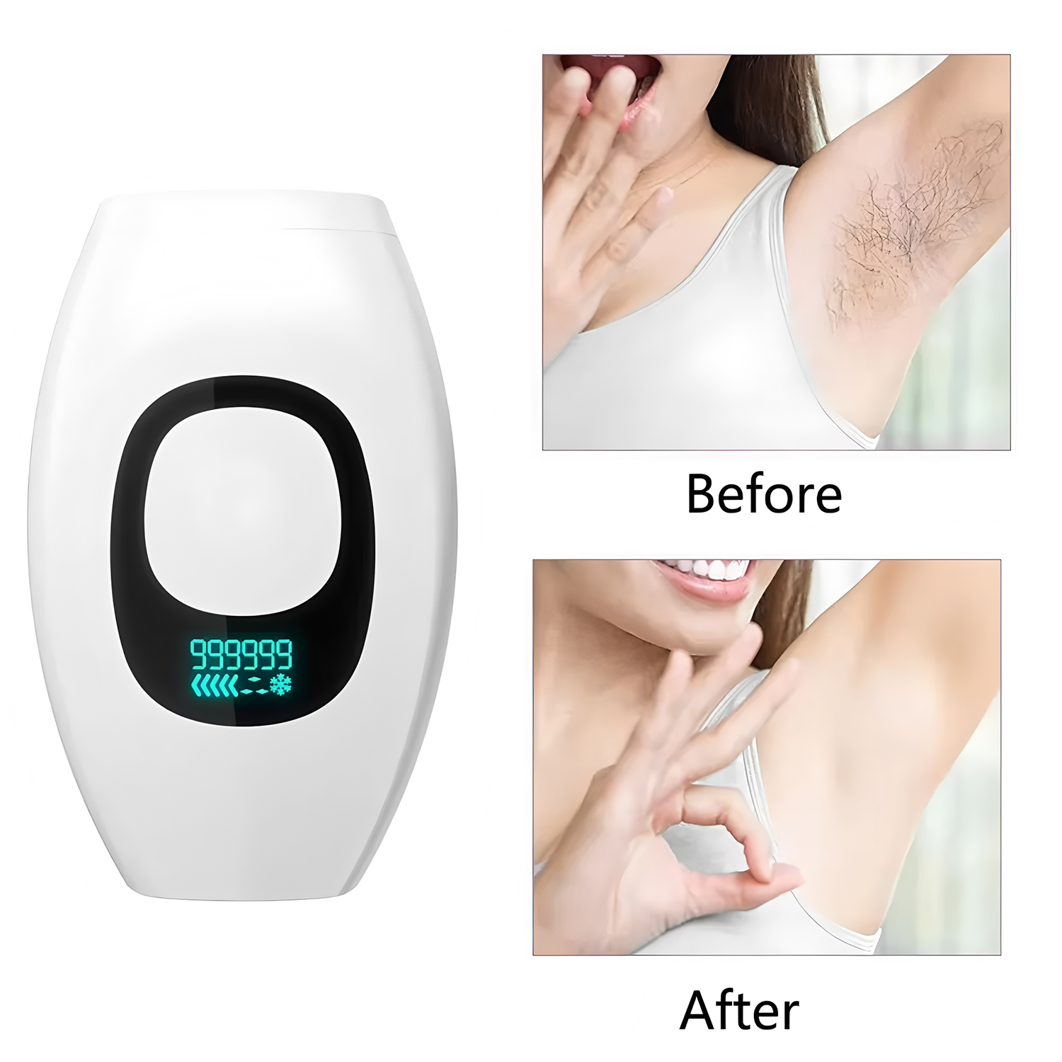 จอแสดงผลดิจิตอล IPL 500,000 แฟ - Opt Ipl Laser Hair Removal Machine บทวิจารณ์และราคา