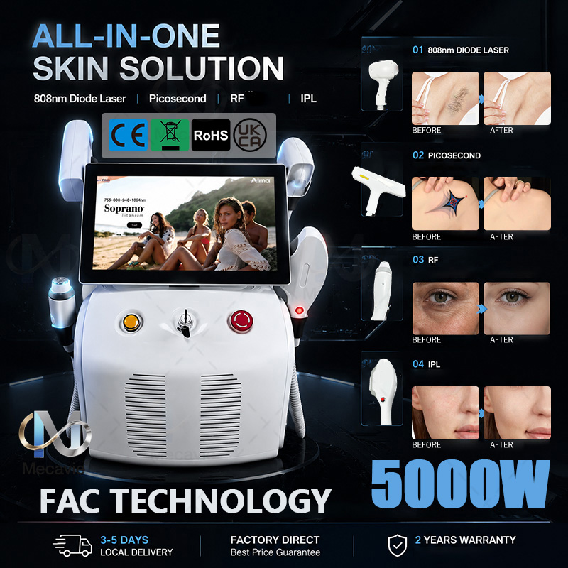 เครื่องกำจัดขน 4IN1 Soprano Ti - Ice Titanium Diode Laser Machine บทวิจารณ์และราคา