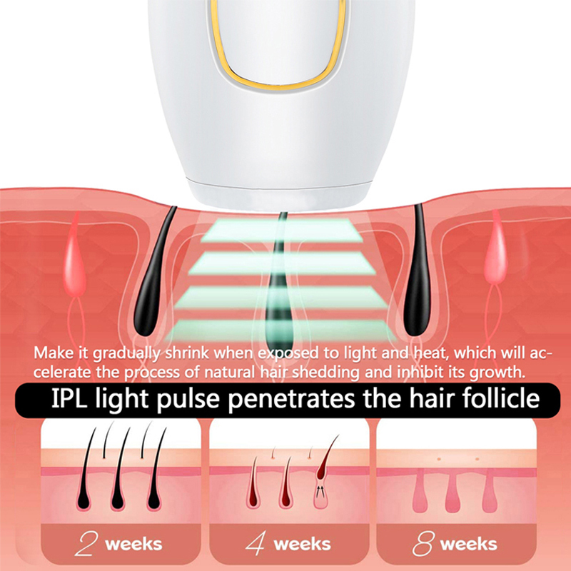 เครื่องกําจัดขนด้วยเลเซอร์ถาวร - Ipl Hair Removal Handset Permanent บทวิจารณ์และราคา