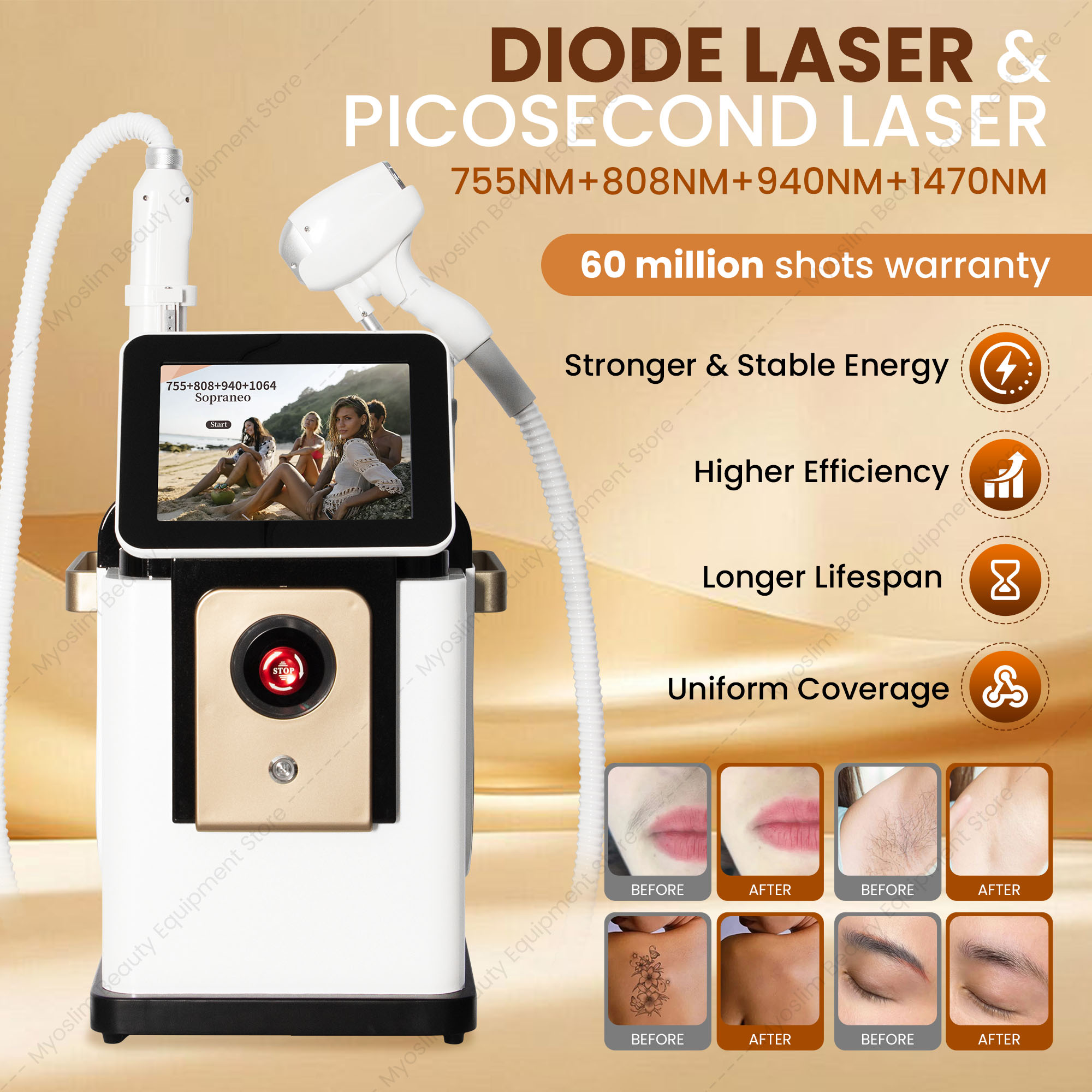 เครื่องกำจัดขนด้วยเลเซอร์ไดโอด - Diode Laser Hair Removal 808Nm 755Nm 1064Nm บทวิจารณ์และราคา