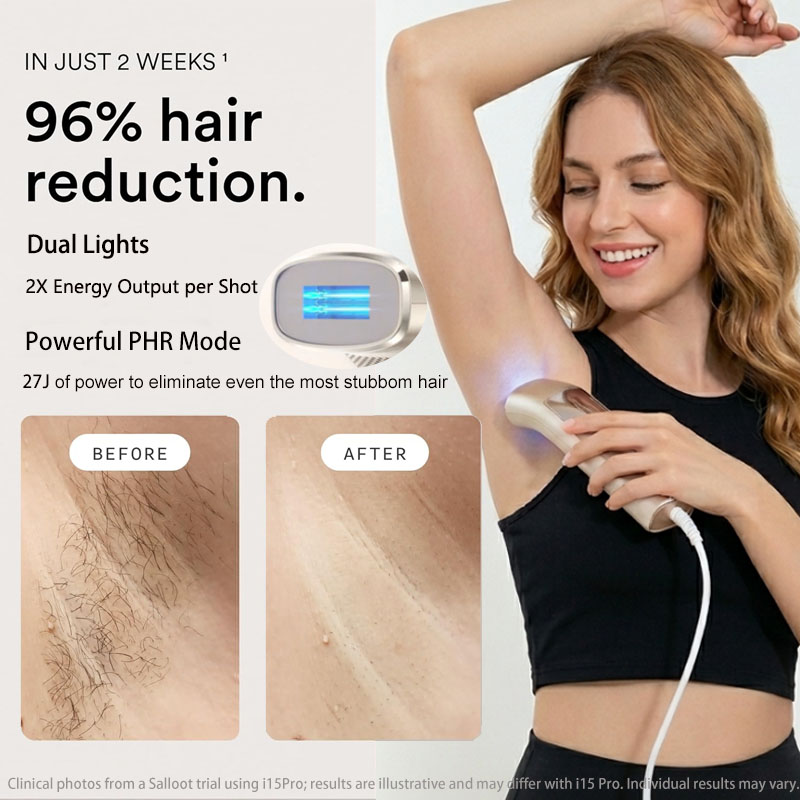 เครื่องกำจัดขนด้วยเลเซอร์ Trin - Home Ipl Hair Removal Sapphire Cooling บทวิจารณ์และราคา
