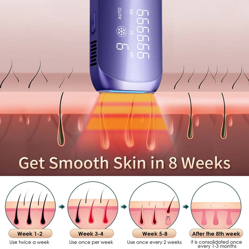 เครื่องกำจัดขน IPL แบบพกพา ขนา - Ipl Hair Removal Handset Permanent บทวิจารณ์และราคา