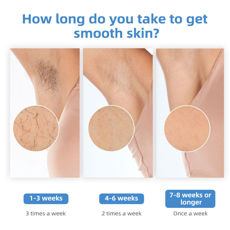 IShine Sapphire Ice Cooling IP - Home Ipl Hair Removal Sapphire Cooling บทวิจารณ์และราคา